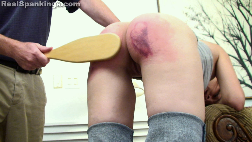 Asian Spanking Bruised Butts - The Spanking Blog - Spanking News, Spanking Reviews and ...