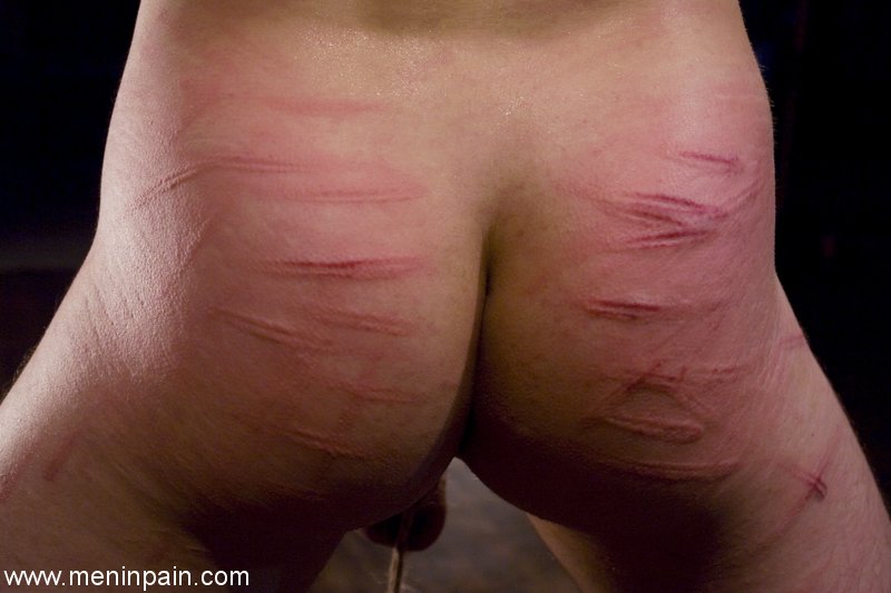 Extreme Caning Marks - The Spanking Blog - Spanking News, Spanking Reviews and Spanking Articles.  True accounts of corporal punishment.