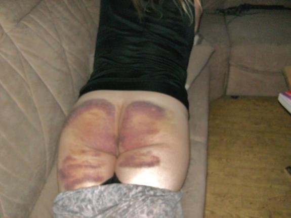 Most Severe Spanking - The Spanking Blog - Spanking News, Spanking Reviews and ...